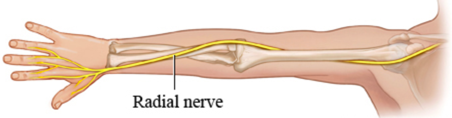 Anatomical diagram showing the radial nerve running through the forearm